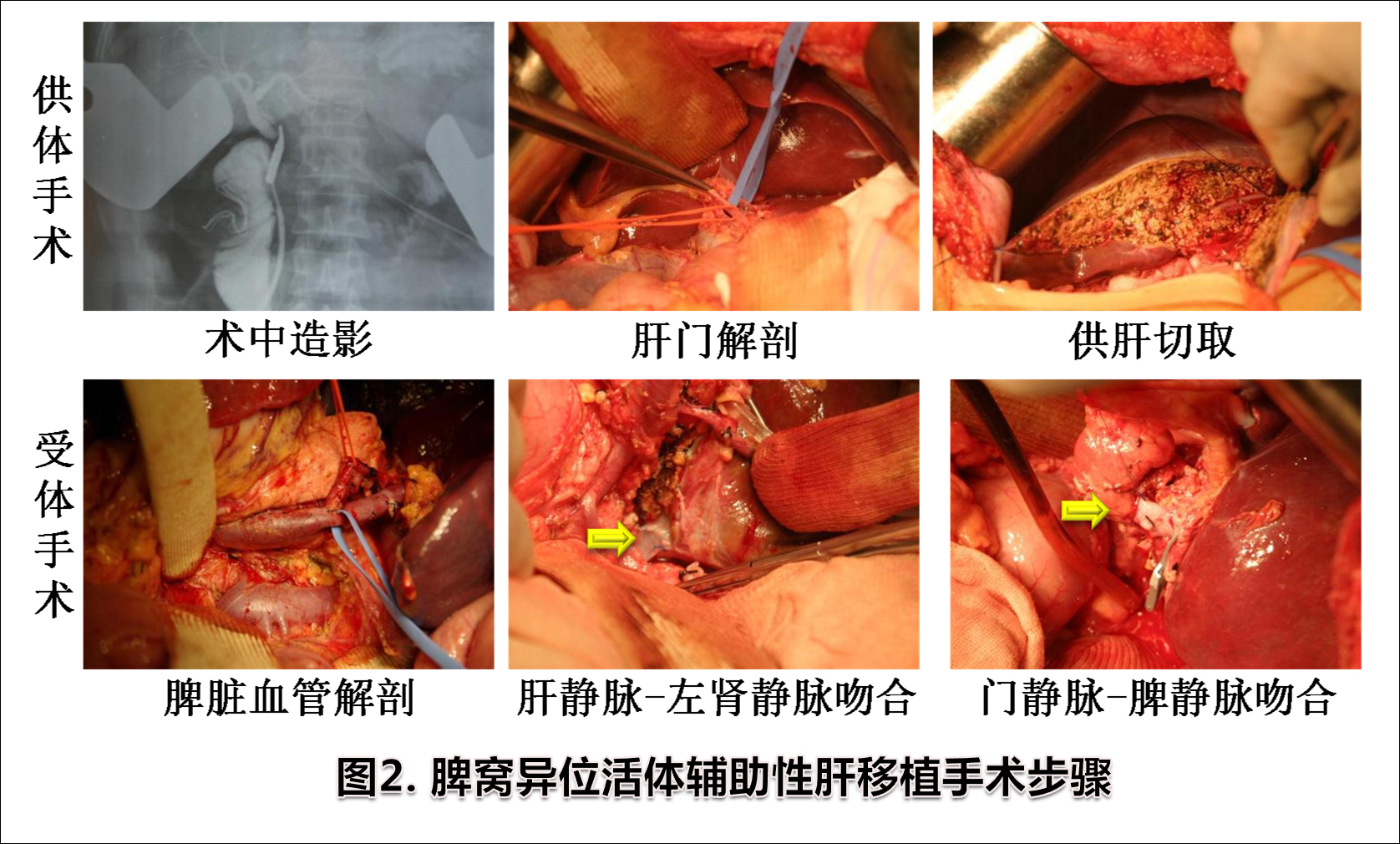 图片2-术中情况.jpg