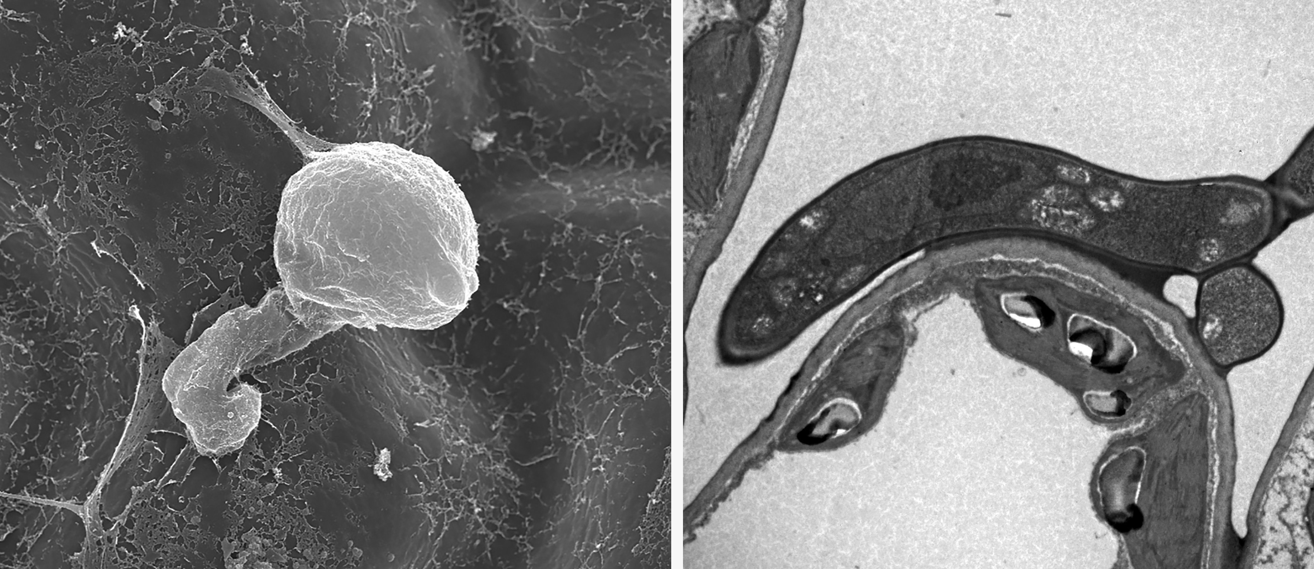 图2 小麦条锈菌在小檗叶片上的侵染（左）与组织中的扩展（右）.jpg