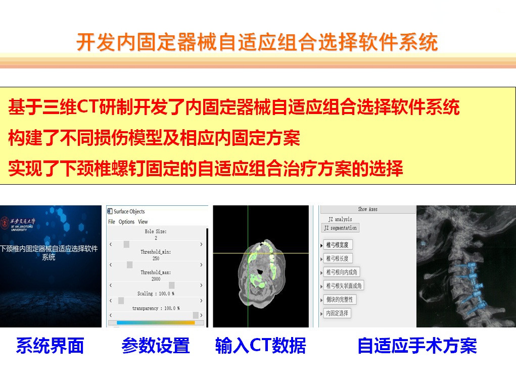 3-开发内固定器械自适应组合选择软件系统.jpg